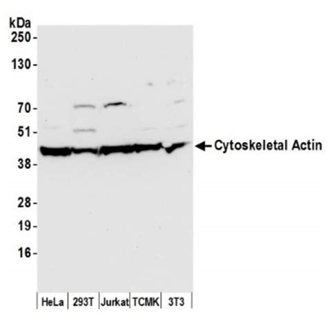 Beta Actin Antibody (600.